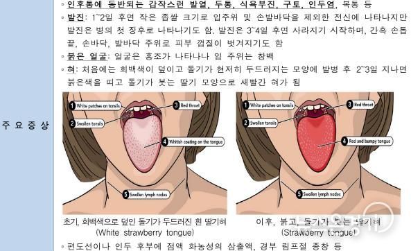 오산시, 성홍열 환자 증가에 따른 시민 주의 당부